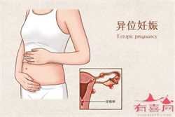 南京北医三院供卵-供卵自怀对母体要求_nt值多少为正常范围，NT值偏高的原因常